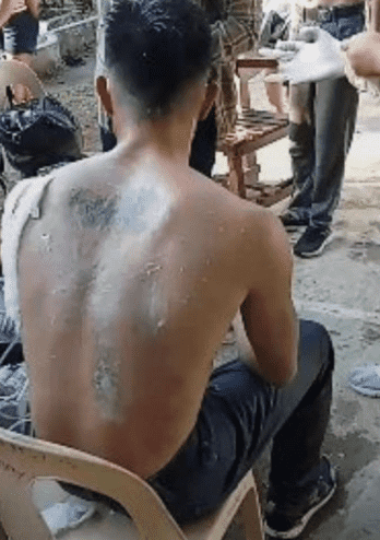 alleged hazing victim