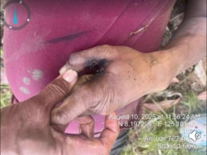samad sa kamot sa nakuryentehan